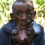7 Unbelievably Scary Health Condition Pictures That Might Horrify You